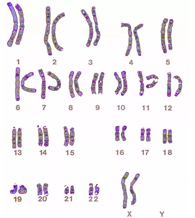 23对染色体